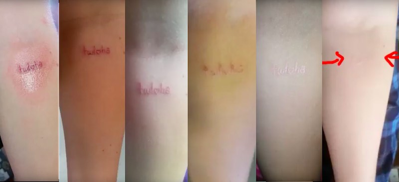 UV Tattoo Healing Process